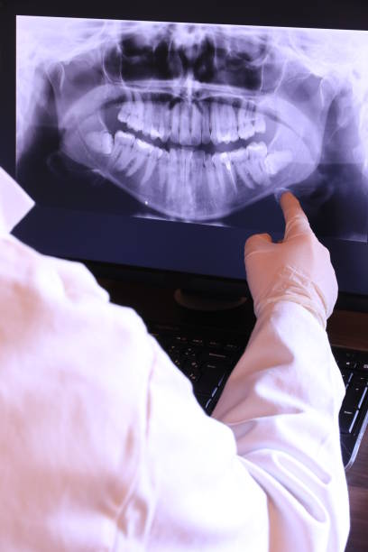 Best Emergency Wisdom Tooth Extraction in Baird, TX