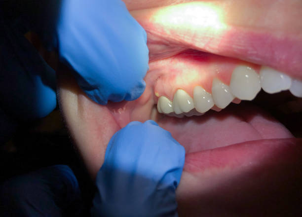 Best Walk-In Emergency Dental Services in Baird, TX