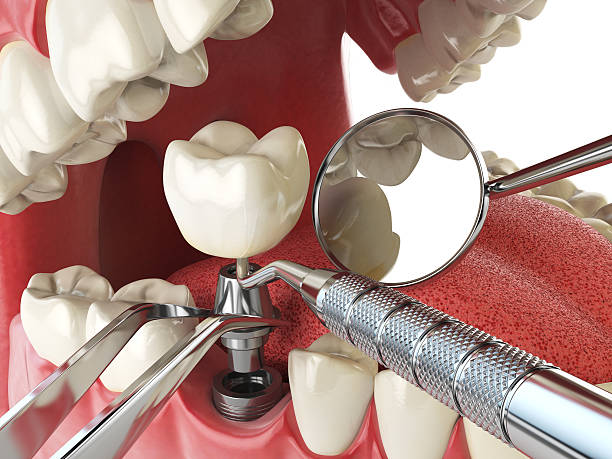 Best Emergency Treatment for Oral Infections in Baird, TX